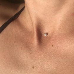 Микродермал