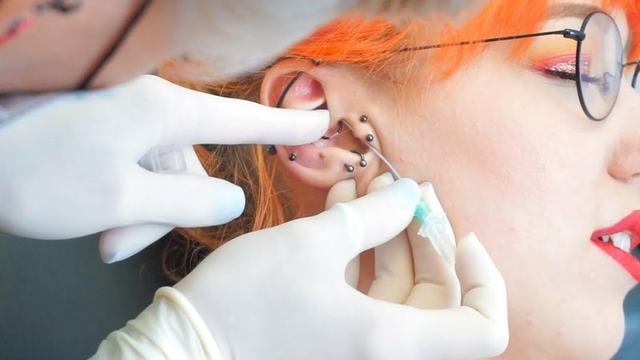 Прокол и рекомендации