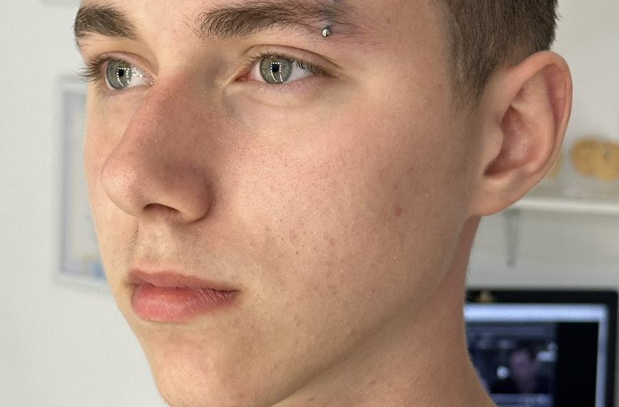 Пирсинг брови