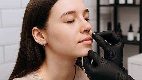 Подготовка и стерилизация